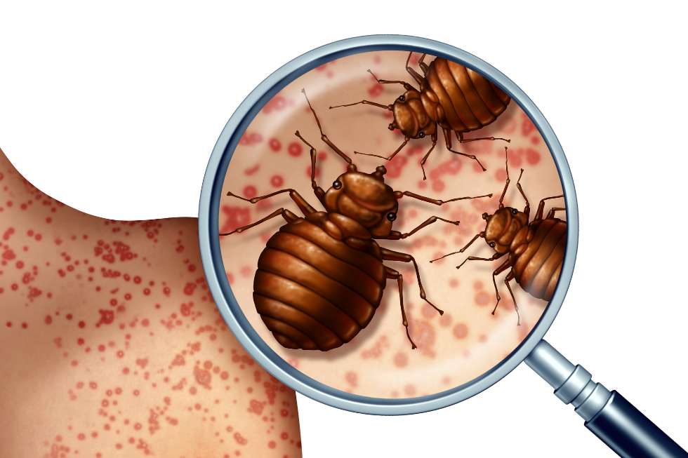 Infestación de chinches