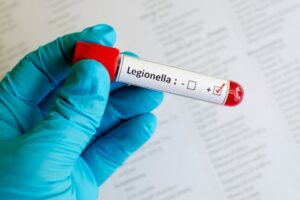Control de la legionella