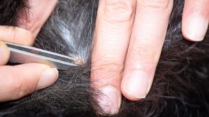 Garrapatas. Control de plagas ICSAM