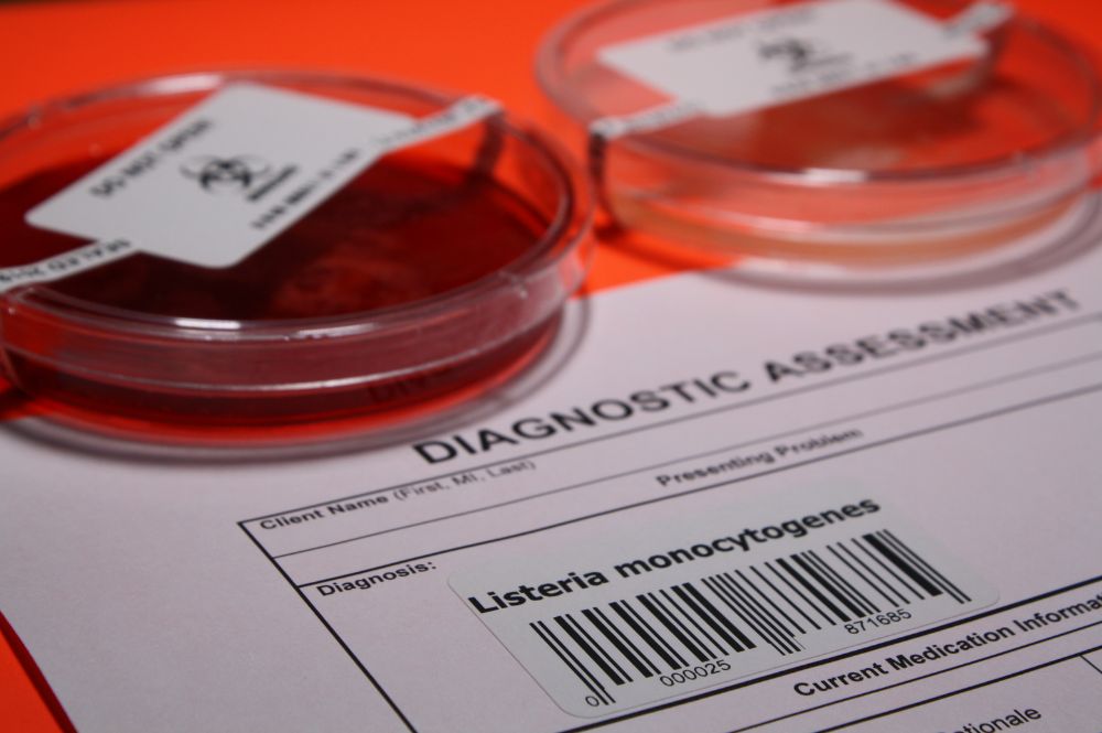 Imagen de placas de análisis para Listeria