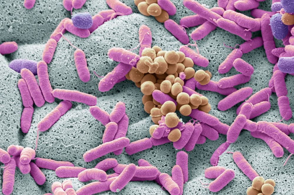 Imagen representativa de la Listeria
